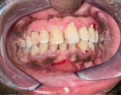 Before Image 4-1-25-1