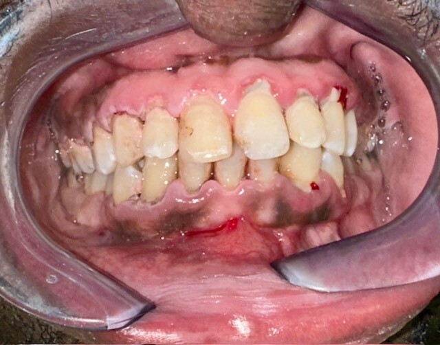 Before Image 4-1-25-1