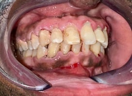 Before Image 4-1-25-2