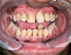 Before Image 4-1-25-4