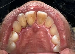 Before Image 4-1-25-5