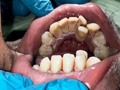 Before Image 4-1-25-6