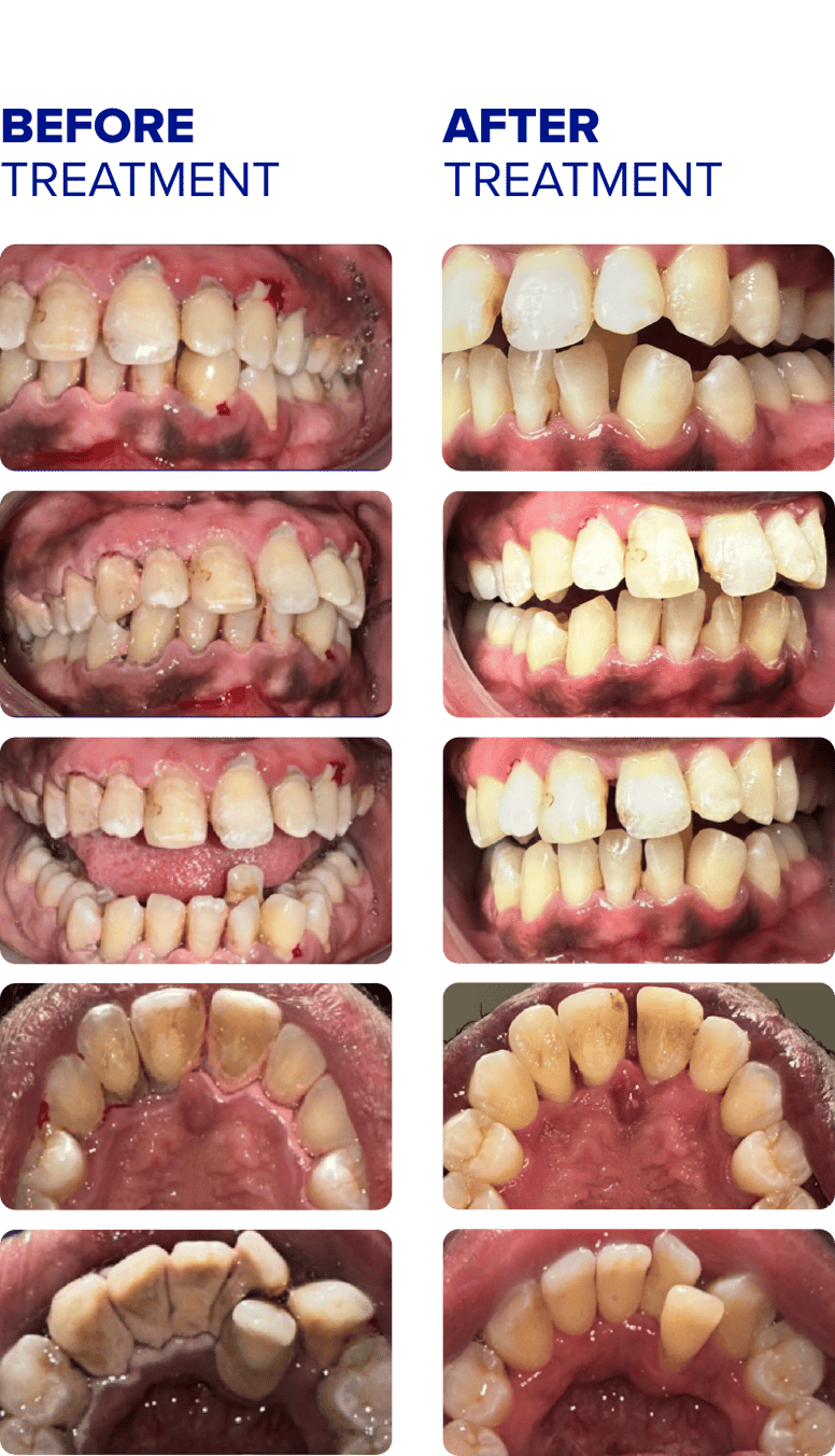 Before and After_PerioDTCaseStudy1