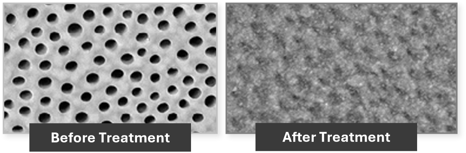 CD_Before_After_Images_06-25