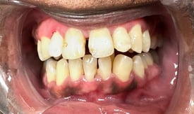 Post Op Image 4-24-25-1