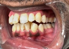Post Op Image 4-24-25-3