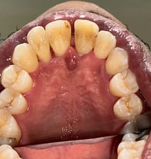 Post Op Image 4-24-25-4