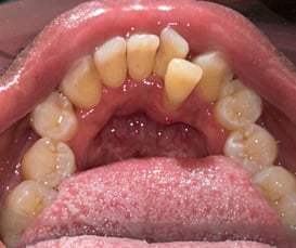 Post Op Image 4-24-25-6