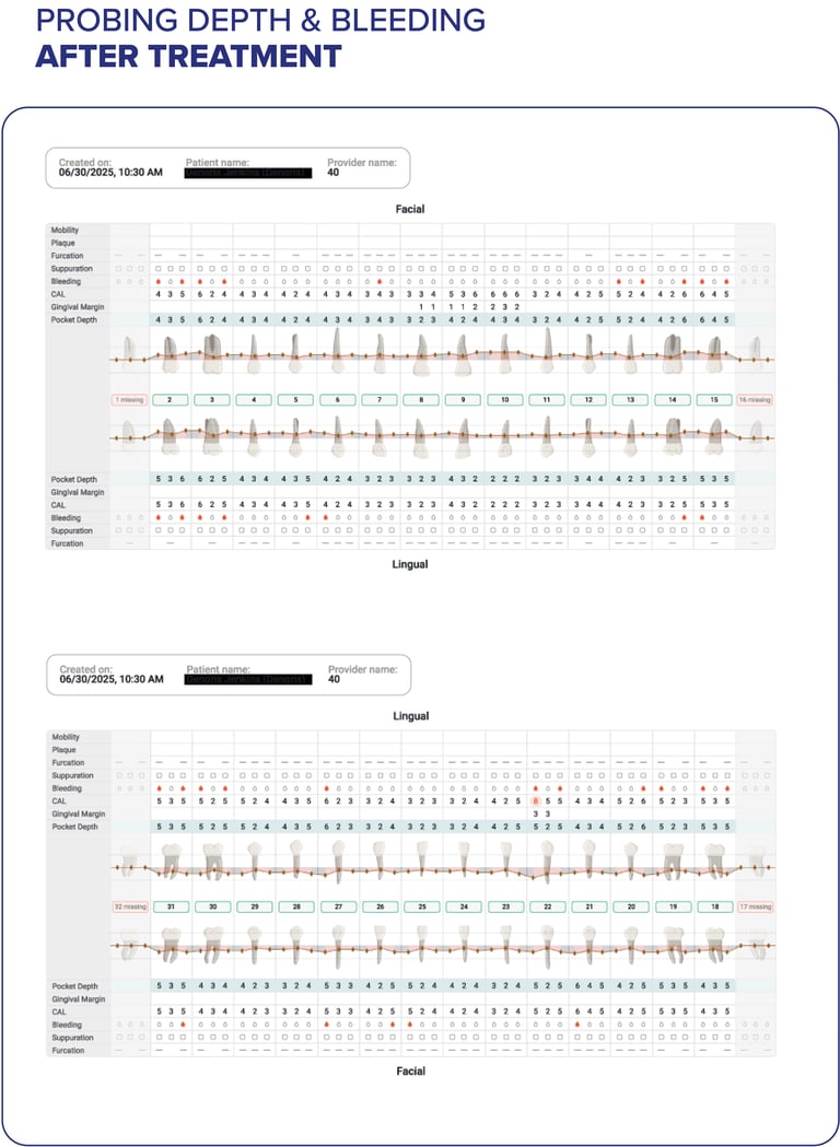 after-treatment-updated-11-01