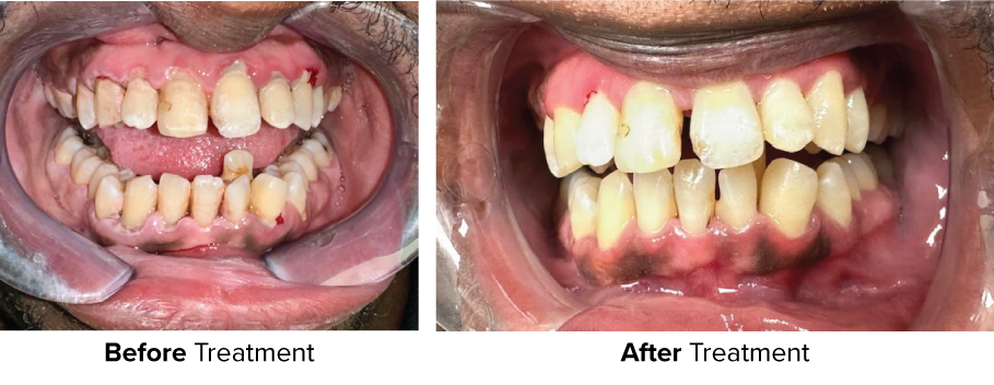 before_and_after_side_by_side_2