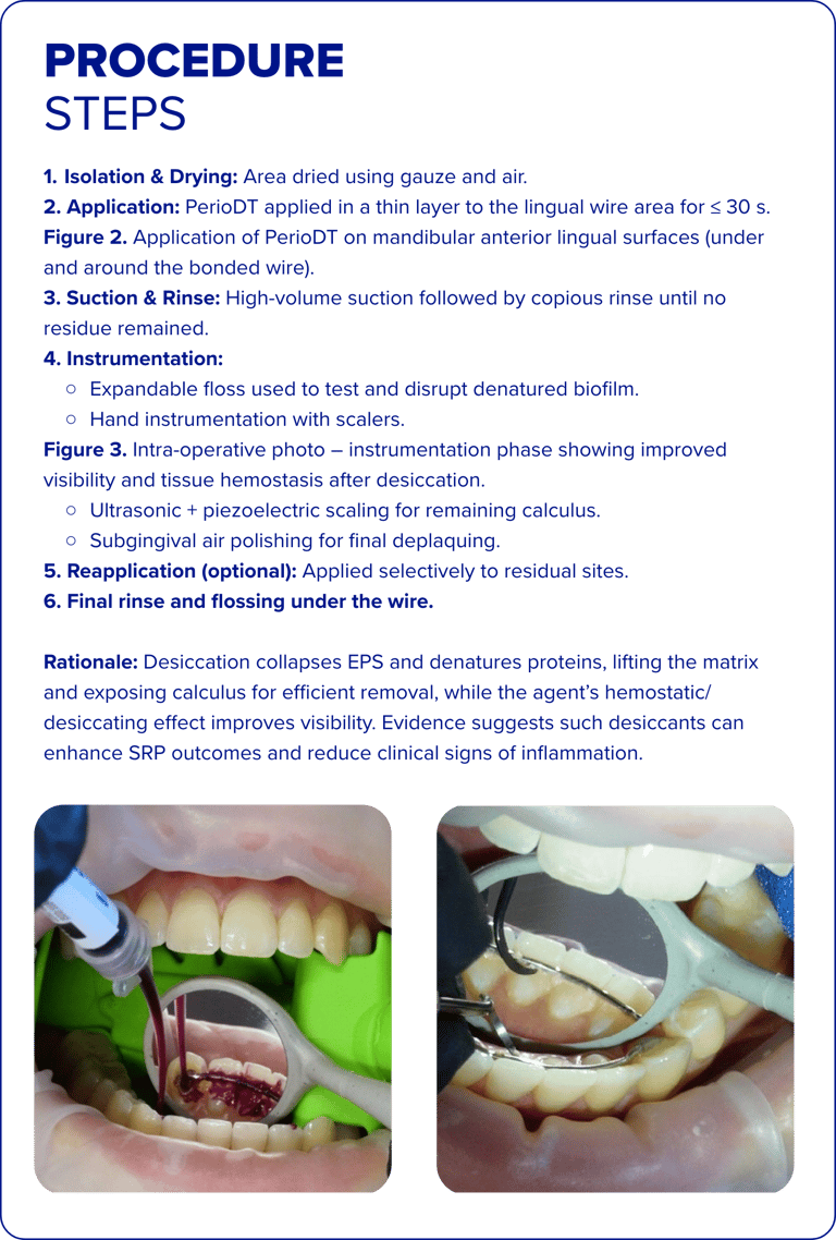 young Procedure Steps