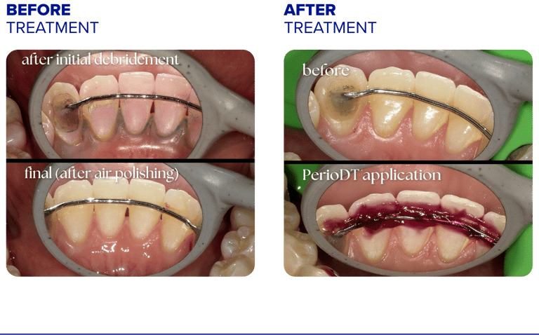 young before and after-1