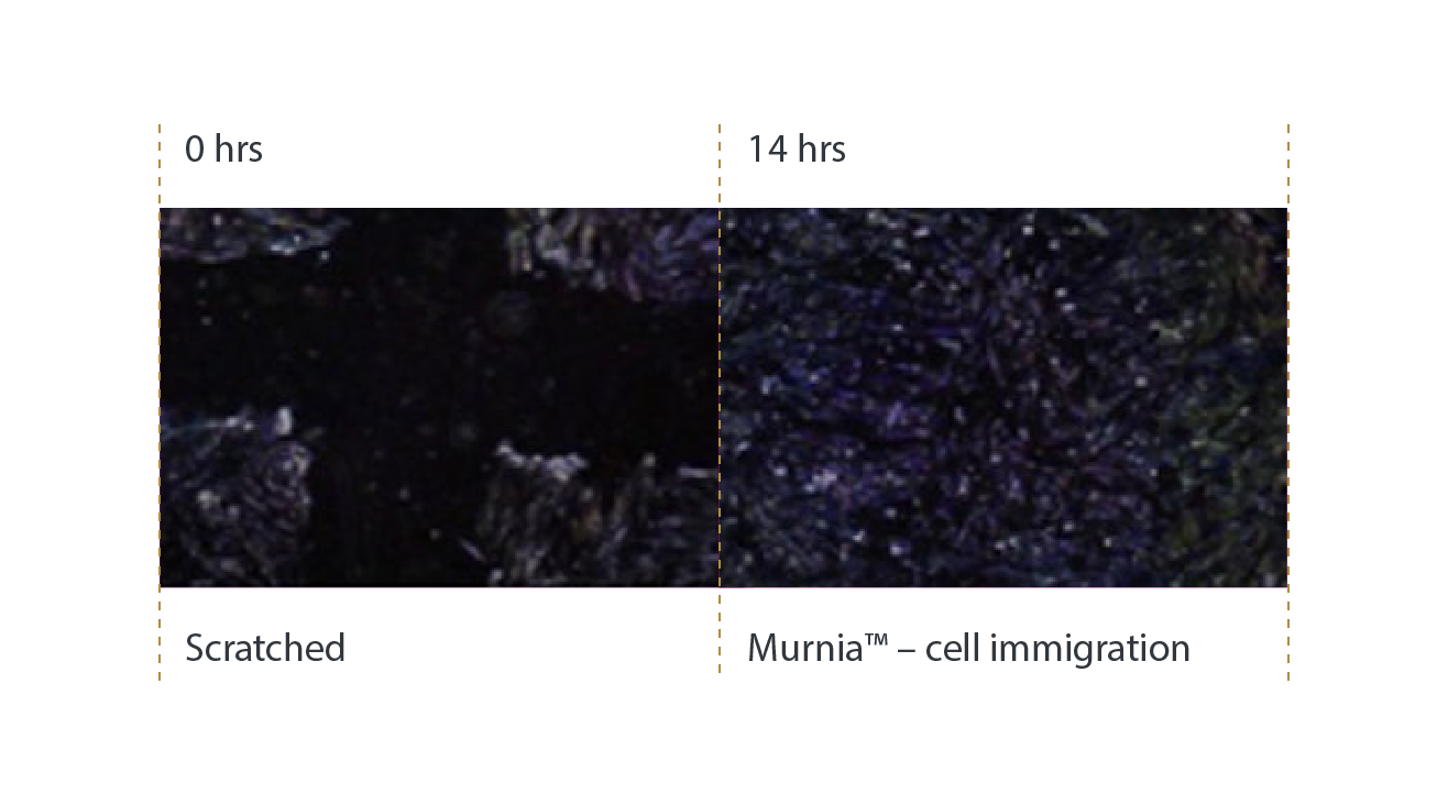 Murnia Before After PD@4x Murnia Before After PD@4x